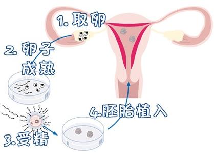 遗传咨询